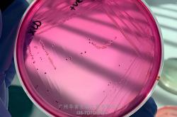 丹麦ssi中国官网中文版