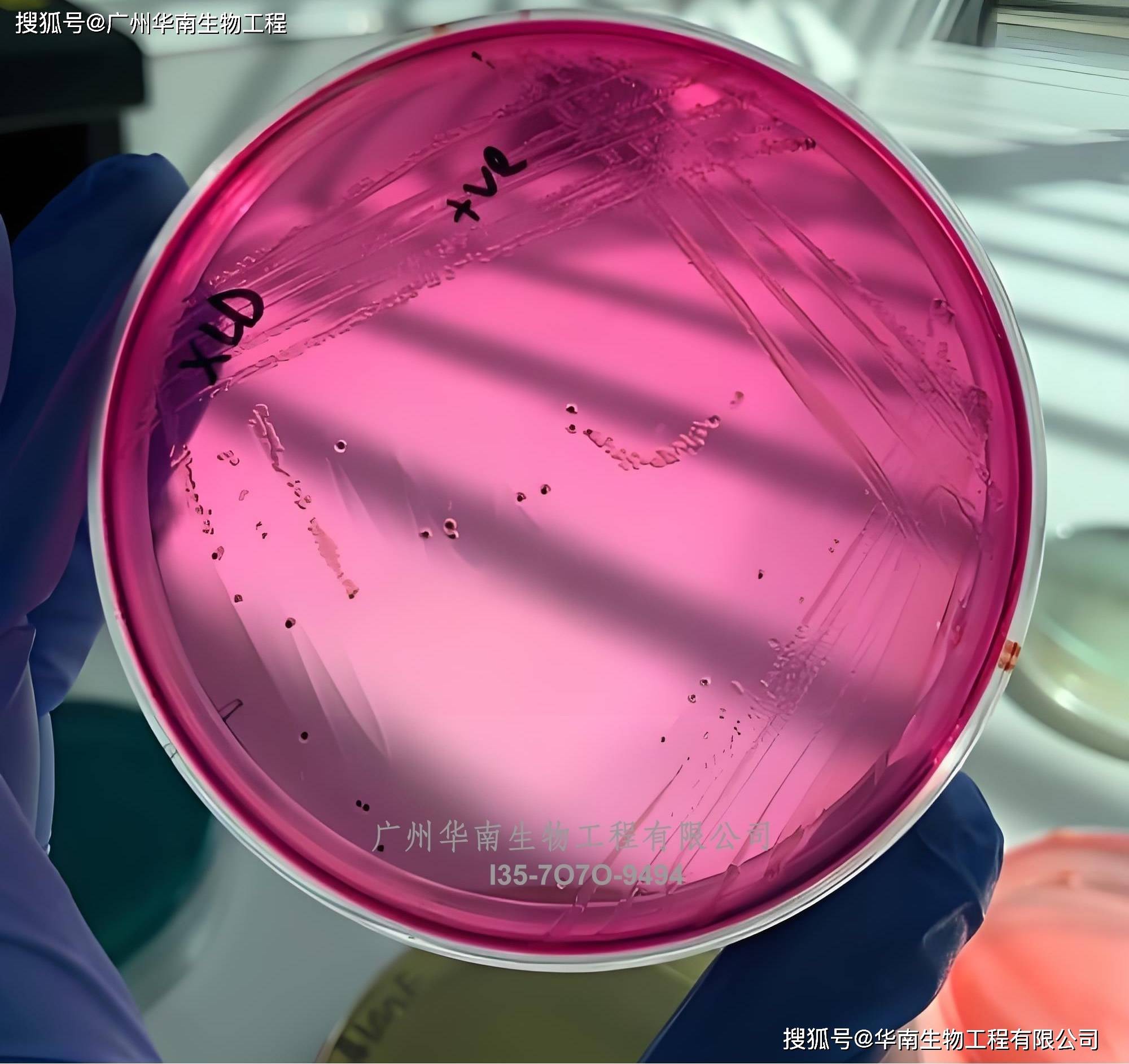 丹麦ssi中国官网中文版